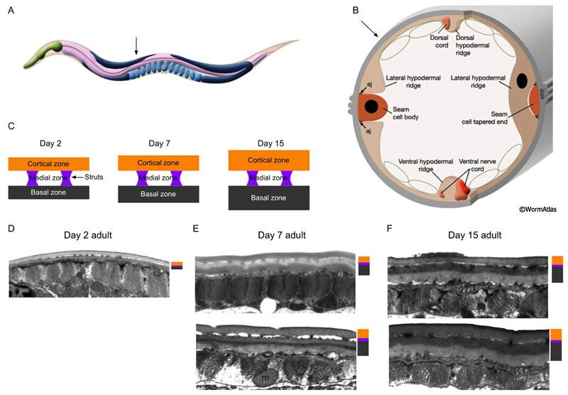 ACutFIG 3: Cuticle growth during aging in the midbody region