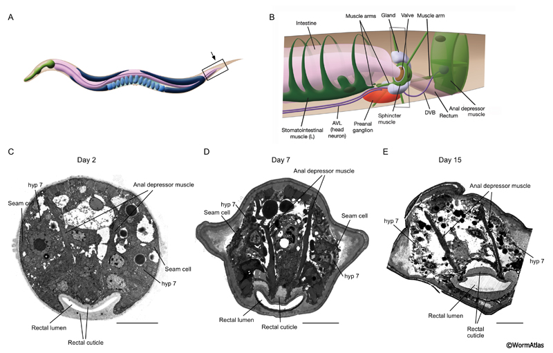 ACutFIG 5: Rectal cuticle growth during aging. 