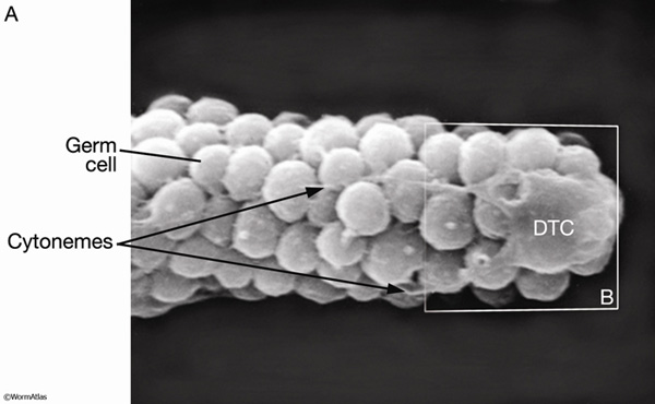 SomaticFIG 2A: Scanning electron micrograph of the DTC