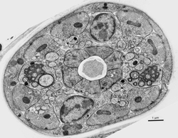 High Pressure Freeze Embryo Amphid