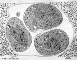 High Pressure Freeze embryo