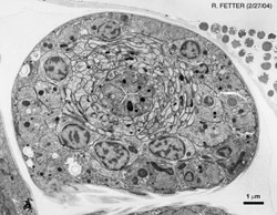 High Pressure Freeze Embryo Nerve Ring